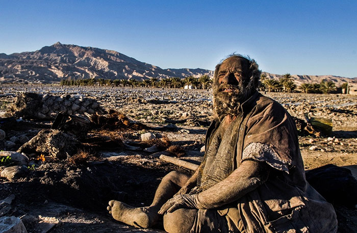Iranian Man hasn't bathed