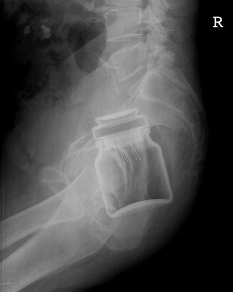 crazy xrays