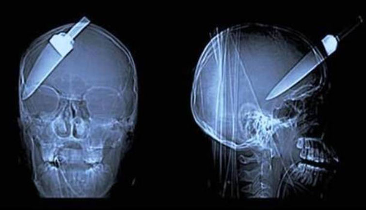 crazy xrays