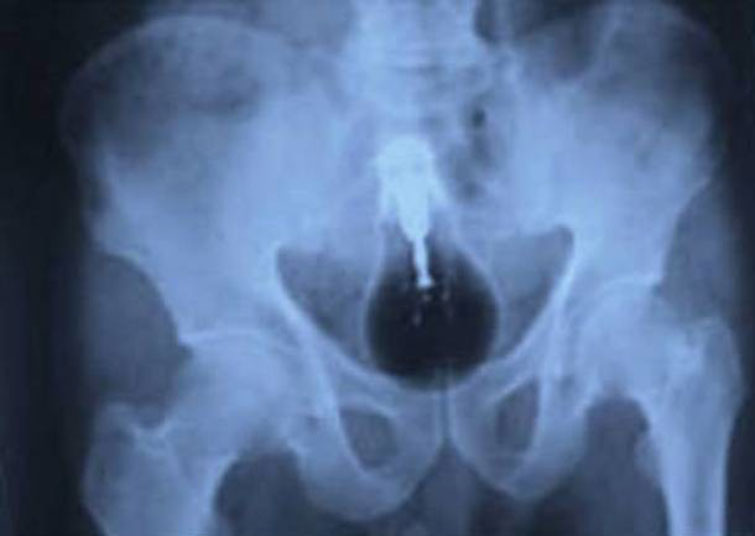 crazy xrays