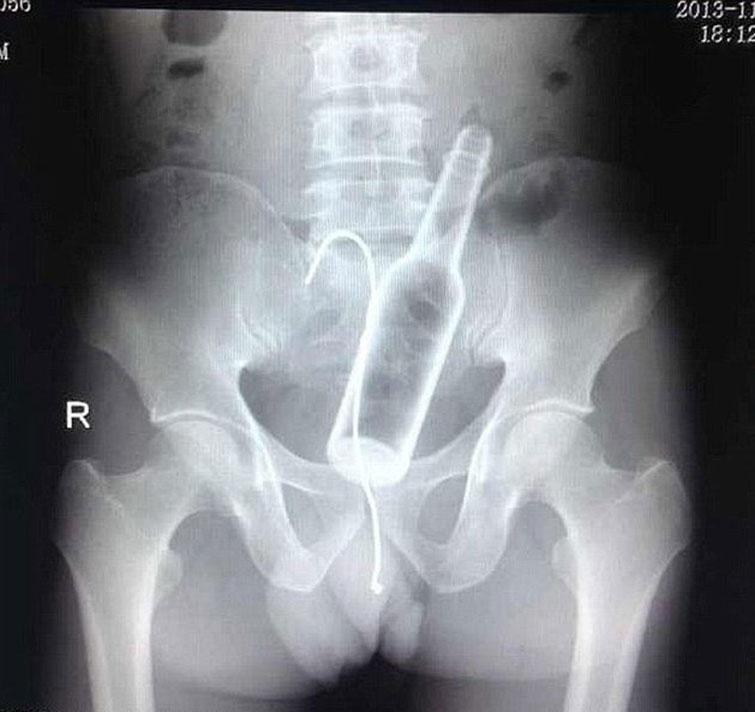 crazy xrays
