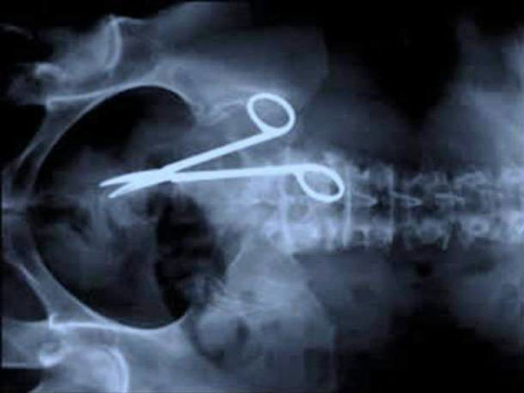 crazy xrays