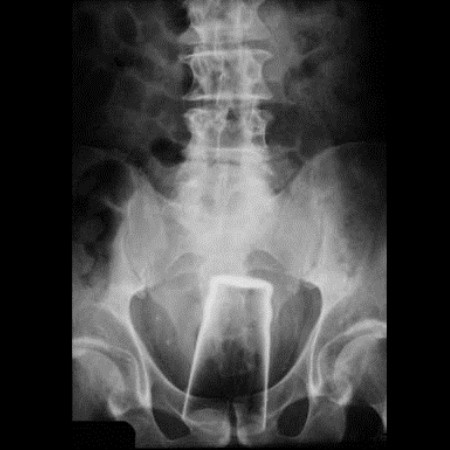 crazy xrays