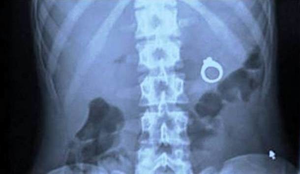 crazy xrays