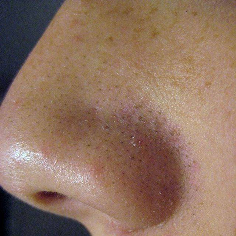 Human Skin facts