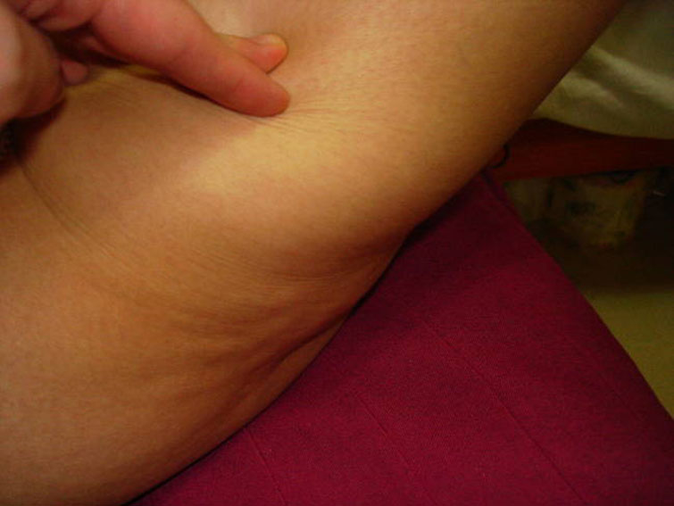 Human Skin facts