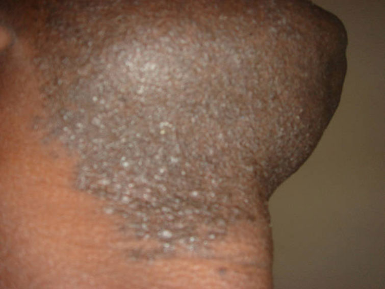 Human Skin facts
