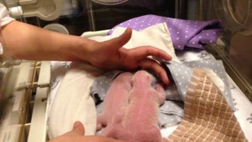 Panda Twins Born At Toronto Zoo