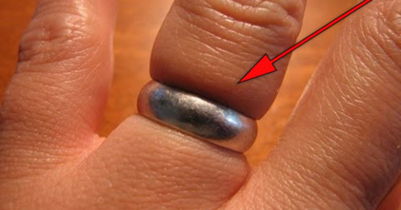 Ring Stuck