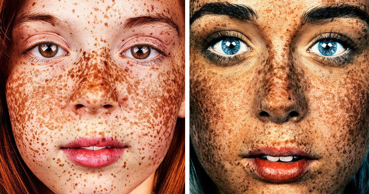 freckles portrait photography brock elbank