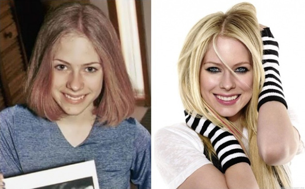  Before After Famous photos