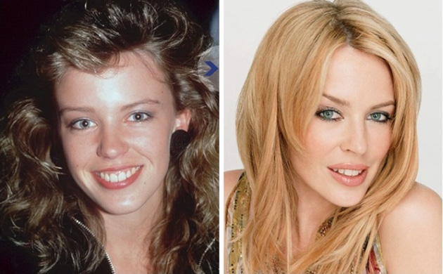  Before After Famous photos
