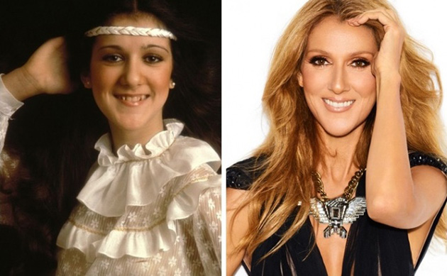  Before After Famous photos