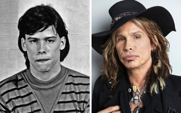  Before After Famous photos