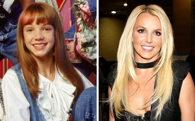  Before After Famous photos