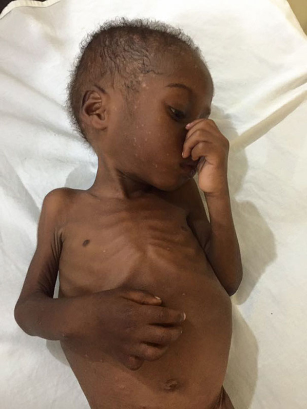 nigerian-starving-thirsty-boy-hope-rescued