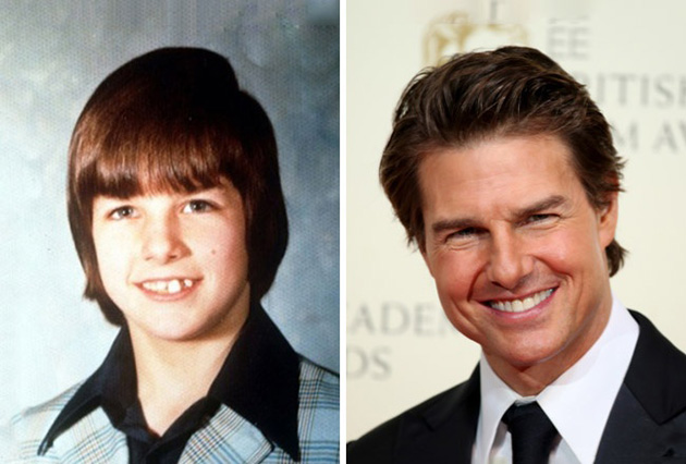 Celebrities Puberty