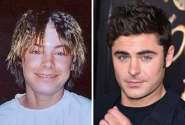 15 Celebrities Who Blossomed After Puberty