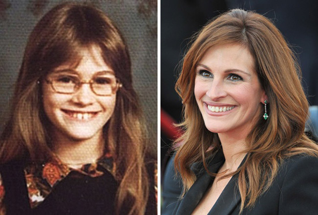 Celebrities Puberty