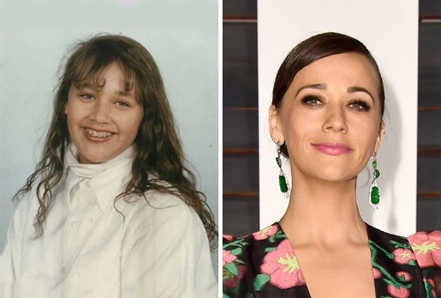 15 Celebrities Who Blossomed After Puberty