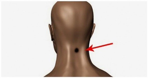 neck-ice-cube-1