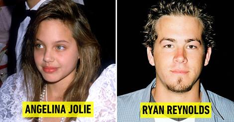 23 Before And After Photos Of Celebrities That Prove Good Teeth Can ...