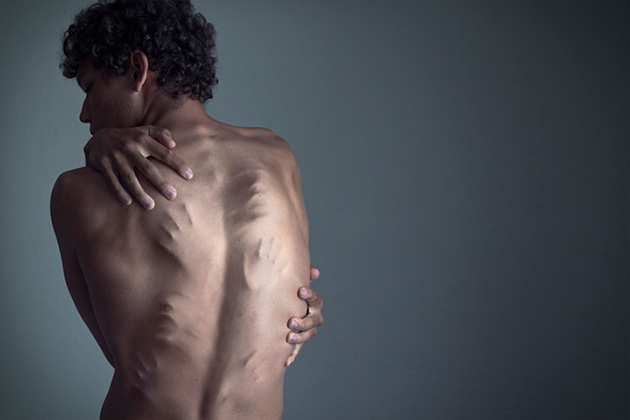 surreal-self-portraits-depression