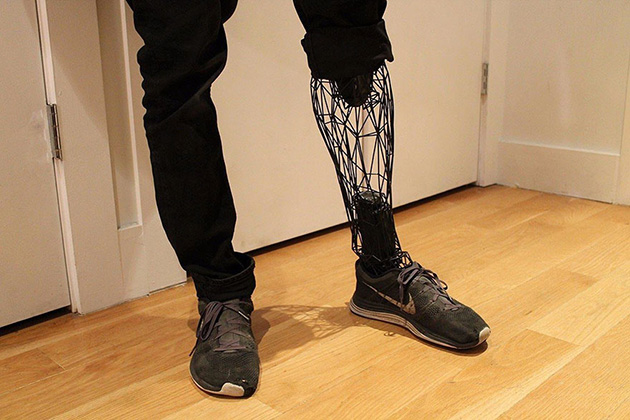 prosthetics leg 3d printed titanium