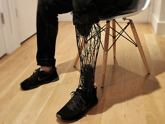 prosthetics leg 3d printed titanium