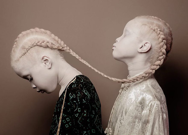 albino-twins-models