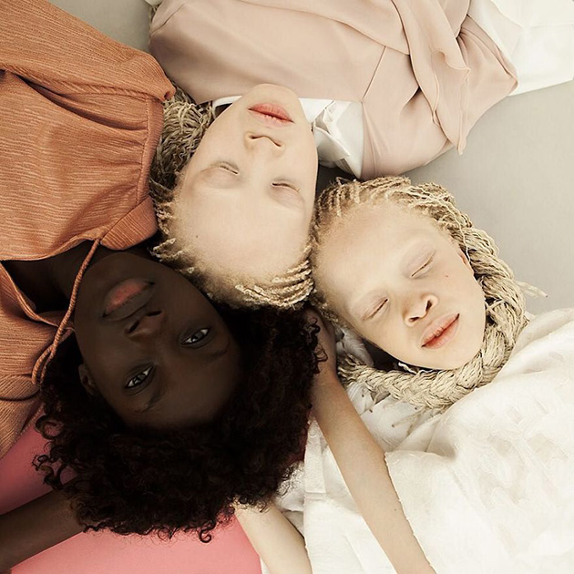 albino-twins-models