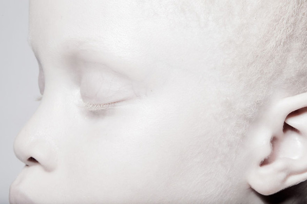 albino-twins-models