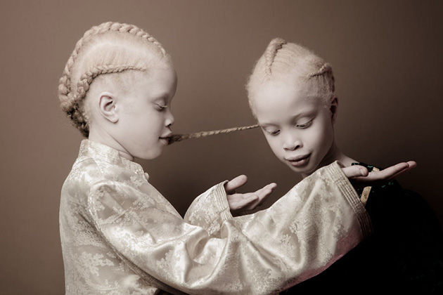 albino-twins-models