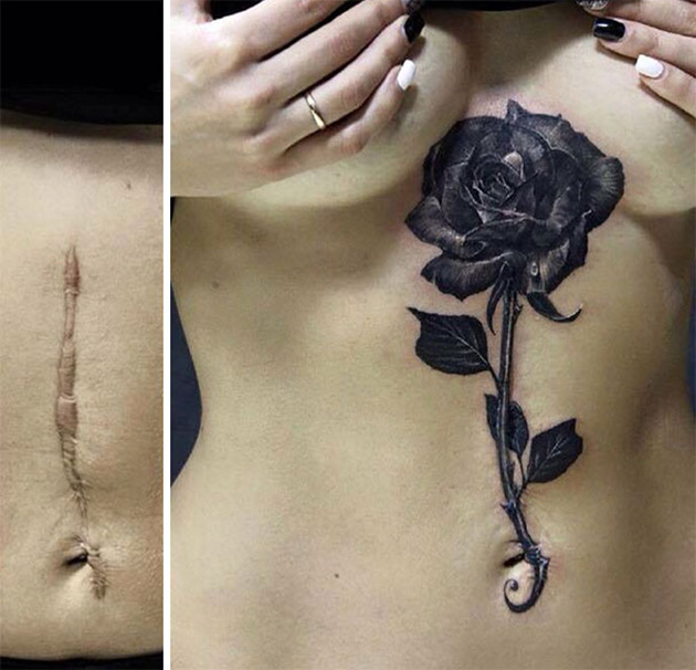 scars tattoo cover up