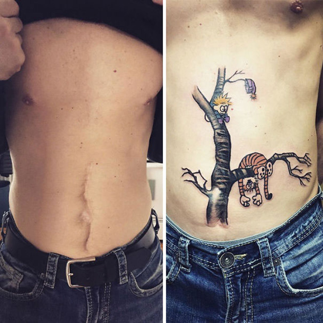 scars tattoo cover up