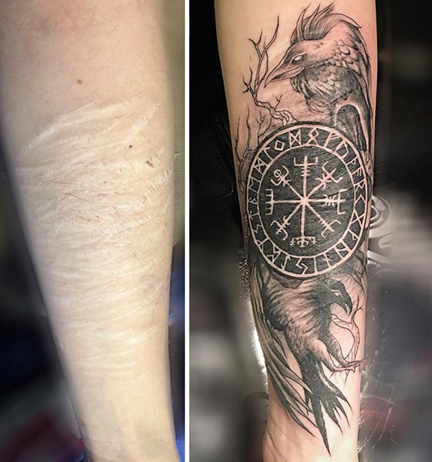 scars tattoo cover up