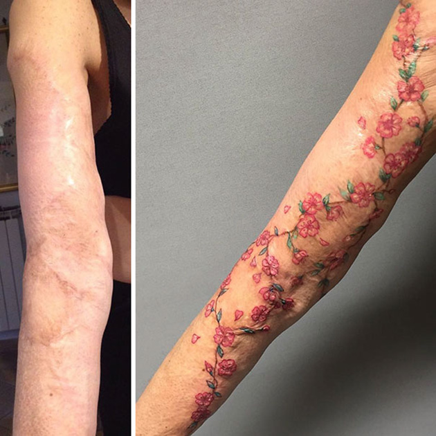 scars tattoo cover up