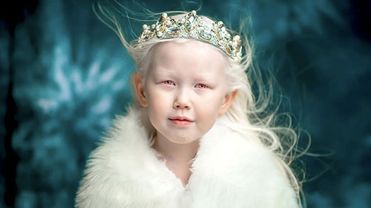 siberian-girl-albino-modeling