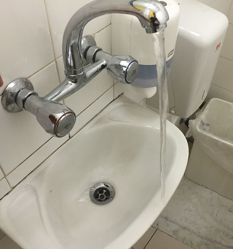 annoying-uncomfortable-disturbing-imperfection-pictures