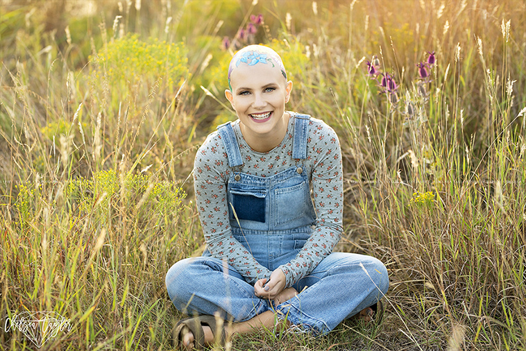 alopecia senior photoshoot