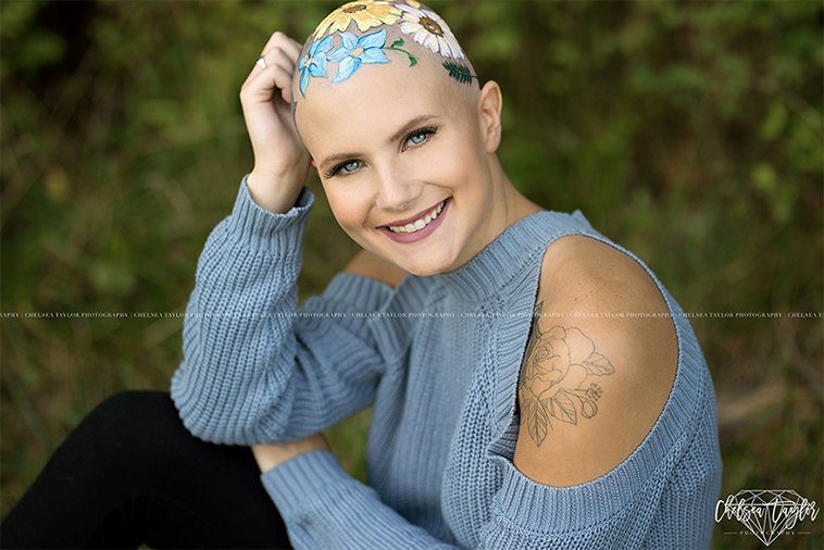 alopecia senior photoshoot
