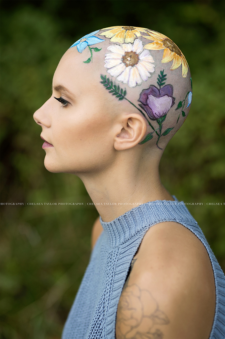 alopecia senior photoshoot