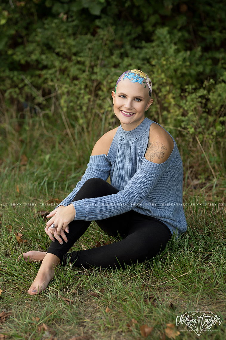 alopecia senior photoshoot