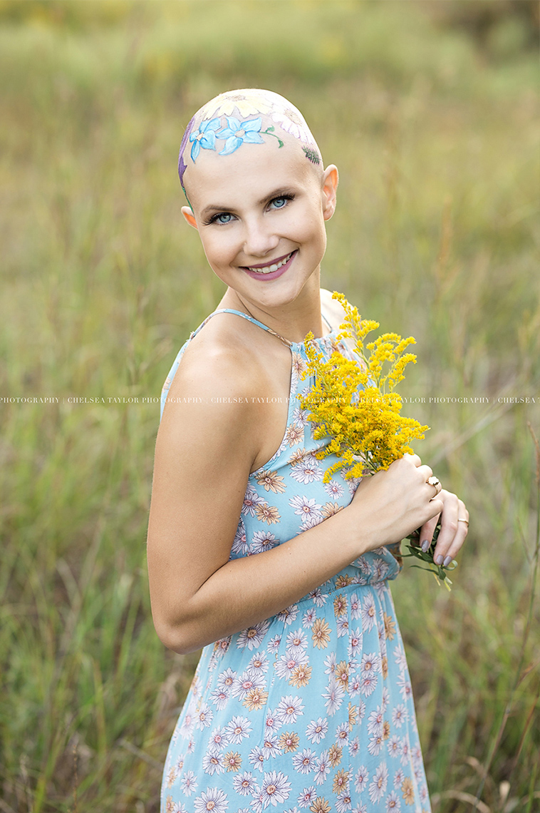 alopecia senior photoshoot