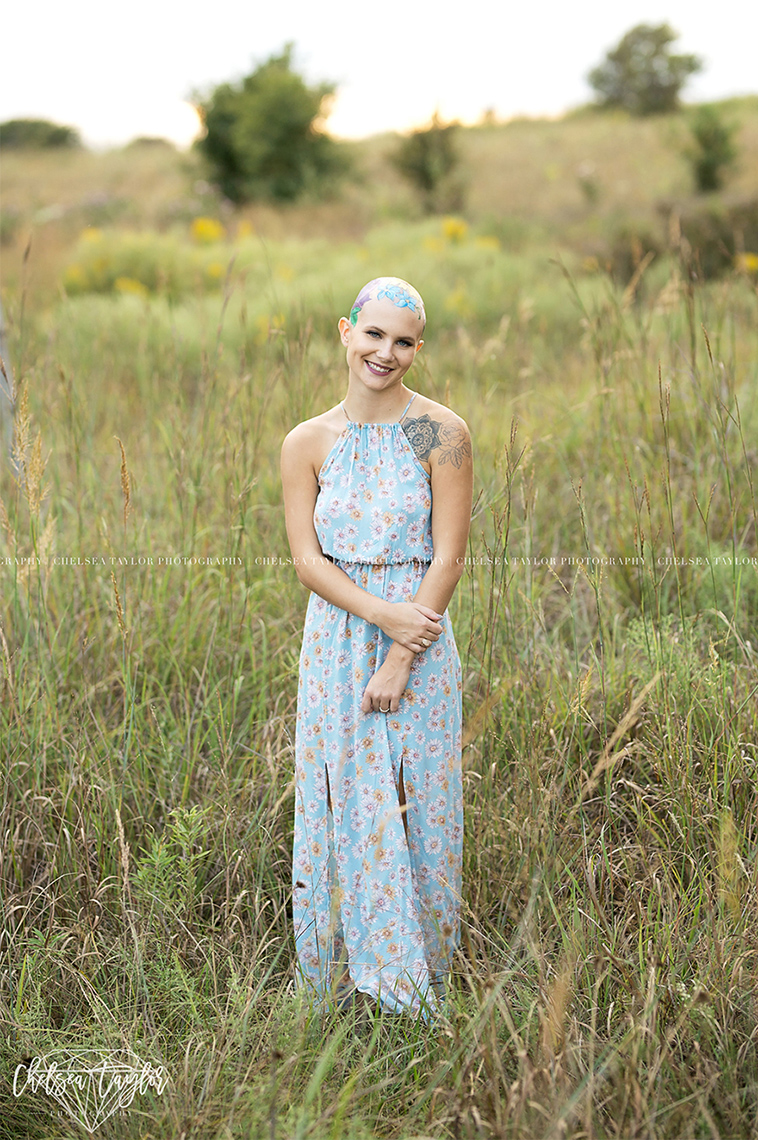 alopecia senior photoshoot