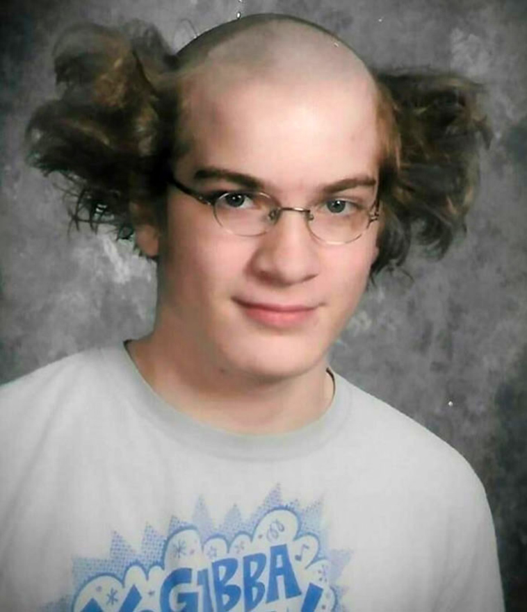most-embarrassing-childhood-photos