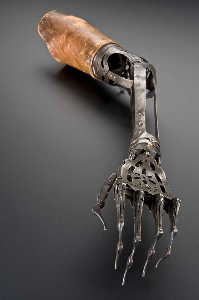 victorian artificial arm