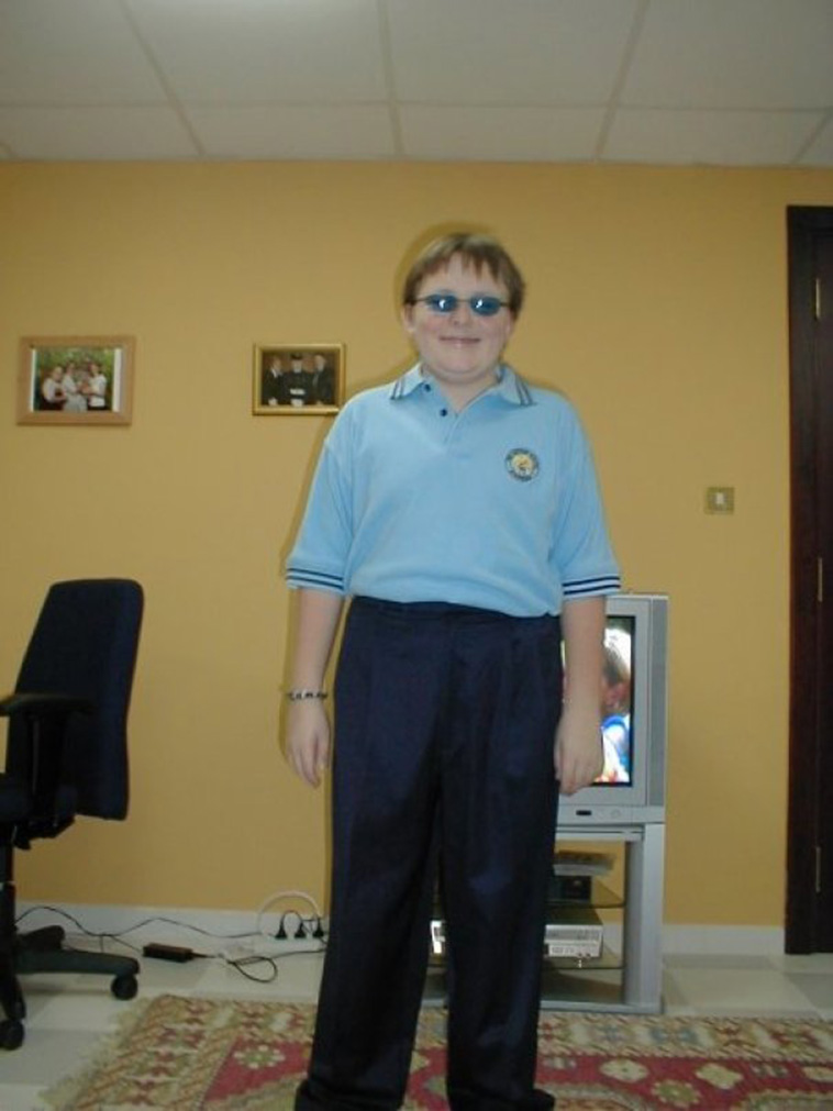 Embarrassing Childhood Photos