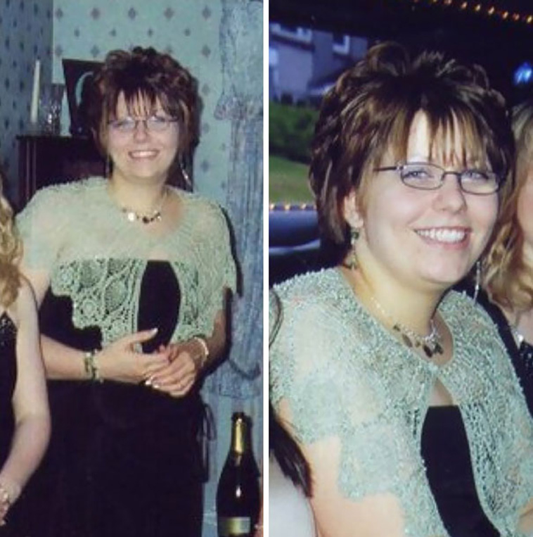 Embarrassing Childhood Photos