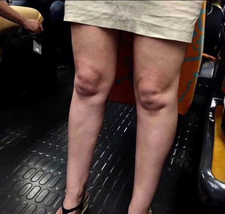 Photos That Deserve an Award